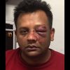 Cabbie Beaten By Skateboard-Wielding Racist